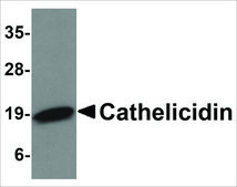 Anti-Cathelicidin antibody produced in rabbit affinity isolated antibody, buffered aqueous solution