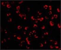 Anti-PAK5 antibody produced in rabbit affinity isolated antibody, buffered aqueous solution