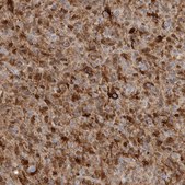 Anti-FABP7 antibody produced in rabbit Prestige Antibodies® Powered by Atlas Antibodies, affinity isolated antibody, buffered aqueous glycerol solution