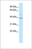 抗 KCNK9 兔抗 affinity isolated antibody