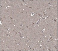 β淀粉样蛋白（ABeta）x-42抗体，克隆12F4 clone 12F4, from mouse