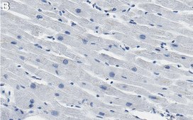 Anti-AGK Antibody, clone 1F21 ZooMAb® Rabbit Monoclonal recombinant, expressed in HEK 293 cells