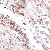 Anti-Vimentin antibody produced in rabbit