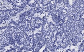 Anti-p-ATM (Ser1981) Antibody, clone 1E19, ZooMAb® Rabbit Monoclonal recombinant, expressed in HEK 293 cells