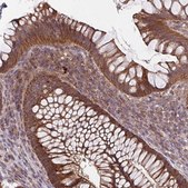 Anti-TTC19 antibody produced in rabbit Prestige Antibodies® Powered by Atlas Antibodies, affinity isolated antibody, buffered aqueous glycerol solution