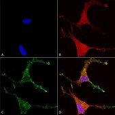 Monoclonal Anti-CACNB2 antibody produced in mouse clone S8B-1, 1 mg/mL, purified immunoglobulin