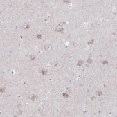 Anti-NAGLU antibody produced in rabbit Prestige Antibodies® Powered by Atlas Antibodies, affinity isolated antibody, buffered aqueous glycerol solution