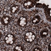 Monoclonal Anti-CS antibody produced in mouse Prestige Antibodies® Powered by Atlas Antibodies, clone CL2548, purified immunoglobulin, buffered aqueous glycerol solution