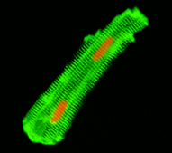 Monoclonal Anti-Desmin antibody produced in mouse clone DE-U-10, ascites fluid