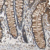 Anti-POR antibody produced in rabbit Prestige Antibodies® Powered by Atlas Antibodies, affinity isolated antibody, buffered aqueous glycerol solution