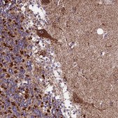Anti-CS antibody produced in rabbit Prestige Antibodies® Powered by Atlas Antibodies, affinity isolated antibody, buffered aqueous glycerol solution
