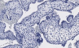 Anti-Keratin 7 Antibody, clone 3O4 ZooMAb® Rabbit Monoclonal recombinant, expressed in HEK 293 cells