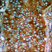 Anti-phospho-PKA CAT (pThr197) antibody produced in rabbit affinity isolated antibody