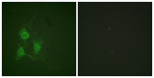 Anti-phospho-PKA α/β CAT (pThr197) antibody produced in rabbit affinity isolated antibody