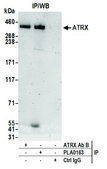 Rabbit anti-ATRX Antibody, Affinity Purified Powered by Bethyl Laboratories, Inc.