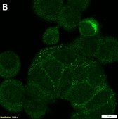 Anti-MMP-7 Antibody, clone 2B3 ZooMAb® Rabbit Monoclonal recombinant, expressed in HEK 293 cells