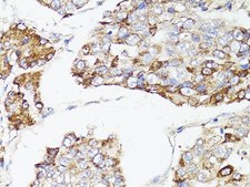 Anti-mTOR antibody produced in rabbit