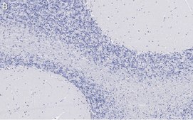 Anti-Bin1 Antibody, clone 99D.2 ZooMAb® Mouse Monoclonal recombinant, expressed in HEK 293 cells