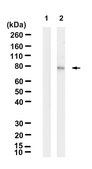 Anti-p-PKCβ (Ser660) Antibody, clone 2C11 ZooMAb® Rabbit Monoclonal recombinant, expressed in HEK 293 cells