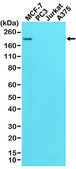 Anti-HER2 antibody, Rabbit monoclonal recombinant, expressed in HEK 293 cells, clone RM228, purified immunoglobulin