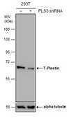 Anti-PLS3 antibody produced in rabbit affinity isolated antibody, buffered aqueous solution