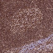 Anti-SIRT6 antibody produced in rabbit Prestige Antibodies® Powered by Atlas Antibodies, affinity isolated antibody, buffered aqueous glycerol solution