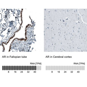 Monoclonal Anti-AR antibody produced in mouse Prestige Antibodies® Powered by Atlas Antibodies, clone CL9255, purified immunoglobulin, buffered aqueous glycerol solution