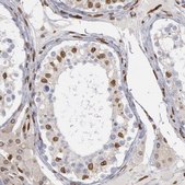 ANTI-SUN2 antibody produced in rabbit Prestige Antibodies® Powered by Atlas Antibodies, affinity isolated antibody, buffered aqueous glycerol solution