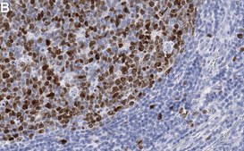 Anti-Topoisomerase II Antibody, clone 3C3 ZooMAb® Rabbit Monoclonal recombinant, expressed in HEK 293 cells