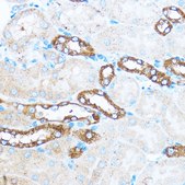 Anti-PIK3CA antibody produced in rabbit