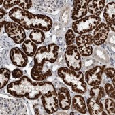 Anti-ACSF2 antibody produced in rabbit Prestige Antibodies® Powered by Atlas Antibodies, affinity isolated antibody, buffered aqueous glycerol solution