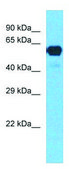 Anti-CYP2E1 affinity isolated antibody