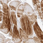 Anti-MAP2K5 antibody produced in rabbit Prestige Antibodies® Powered by Atlas Antibodies, affinity isolated antibody, buffered aqueous glycerol solution, ab1