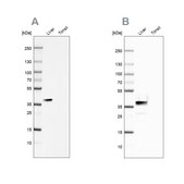 Anti-ARG1 antibody produced in rabbit Prestige Antibodies® Powered by Atlas Antibodies, affinity isolated antibody, buffered aqueous glycerol solution