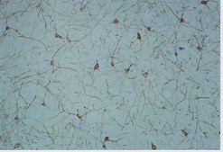 Anti-Opioid Receptor Antibody, δ, pain, NT serum, Chemicon®