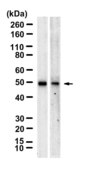 Anti-ARP3 Antibody, clone 1C7 ZooMAb® Rabbit Monoclonal recombinant, expressed in HEK 293 cells