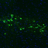 Monoclonal Anti-TH antibody produced in mouse Prestige Antibodies® Powered by Atlas Antibodies, clone CL3049, purified immunoglobulin, buffered aqueous glycerol solution