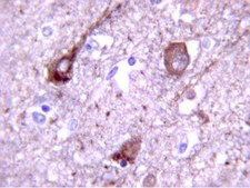 抗Tau磷酸苏氨酸231抗体 Chemicon®, from rabbit