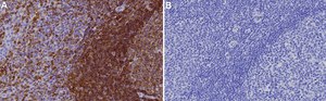 Anti-SHP-1/PTPN6 Antibody, clone 1D20 ZooMAb® Rabbit Monoclonal recombinant, expressed in HEK 293 cells