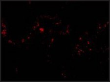 Anti-P53R2 antibody produced in rabbit affinity isolated antibody, buffered aqueous solution