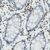 Monoclonal Anti-RUNX2 antibody produced in mouse Prestige Antibodies® Powered by Atlas Antibodies, clone CL0232, purified immunoglobulin, buffered aqueous glycerol solution