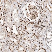 Anti-TCF4 antibody produced in rabbit Prestige Antibodies® Powered by Atlas Antibodies, affinity isolated antibody, buffered aqueous glycerol solution