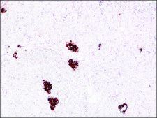 单克隆抗 胰岛素 小鼠抗 clone K36AC10, ascites fluid
