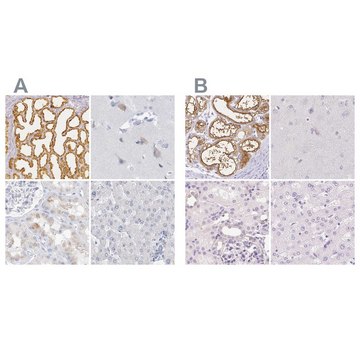 Anti-CSN1S1 antibody produced in rabbit Prestige Antibodies® Powered by Atlas Antibodies, affinity isolated antibody, buffered aqueous glycerol solution