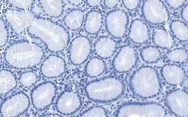 Anti-Integrin α6/CD49f Antibody, clone 5I3 ZooMAb® Rabbit Monoclonal recombinant, expressed in HEK 293 cells