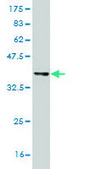 ANTI-IKBKB antibody produced in mouse clone 3C12, purified immunoglobulin, buffered aqueous solution