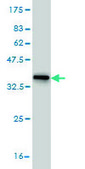 Monoclonal Anti-HDAC5 antibody produced in mouse clone 4G2, purified immunoglobulin, buffered aqueous solution