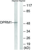 Anti-OPRM1 antibody produced in rabbit affinity isolated antibody