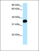 Anti-LDHB affinity isolated antibody