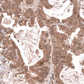 Monoclonal Anti-Lgr5 Antibody Produced In Mouse Prestige Antibodies® Powered by Atlas Antibodies, clone CL13579, affinity isolated antibody, buffered aqueous glycerol solution